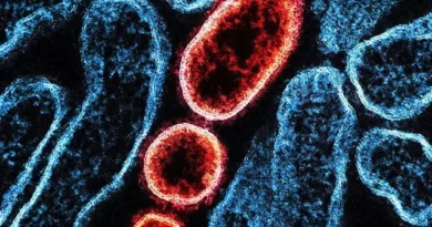 virus nipah