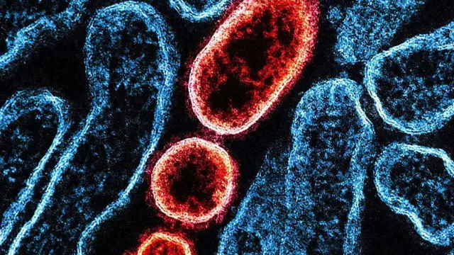 virus nipah